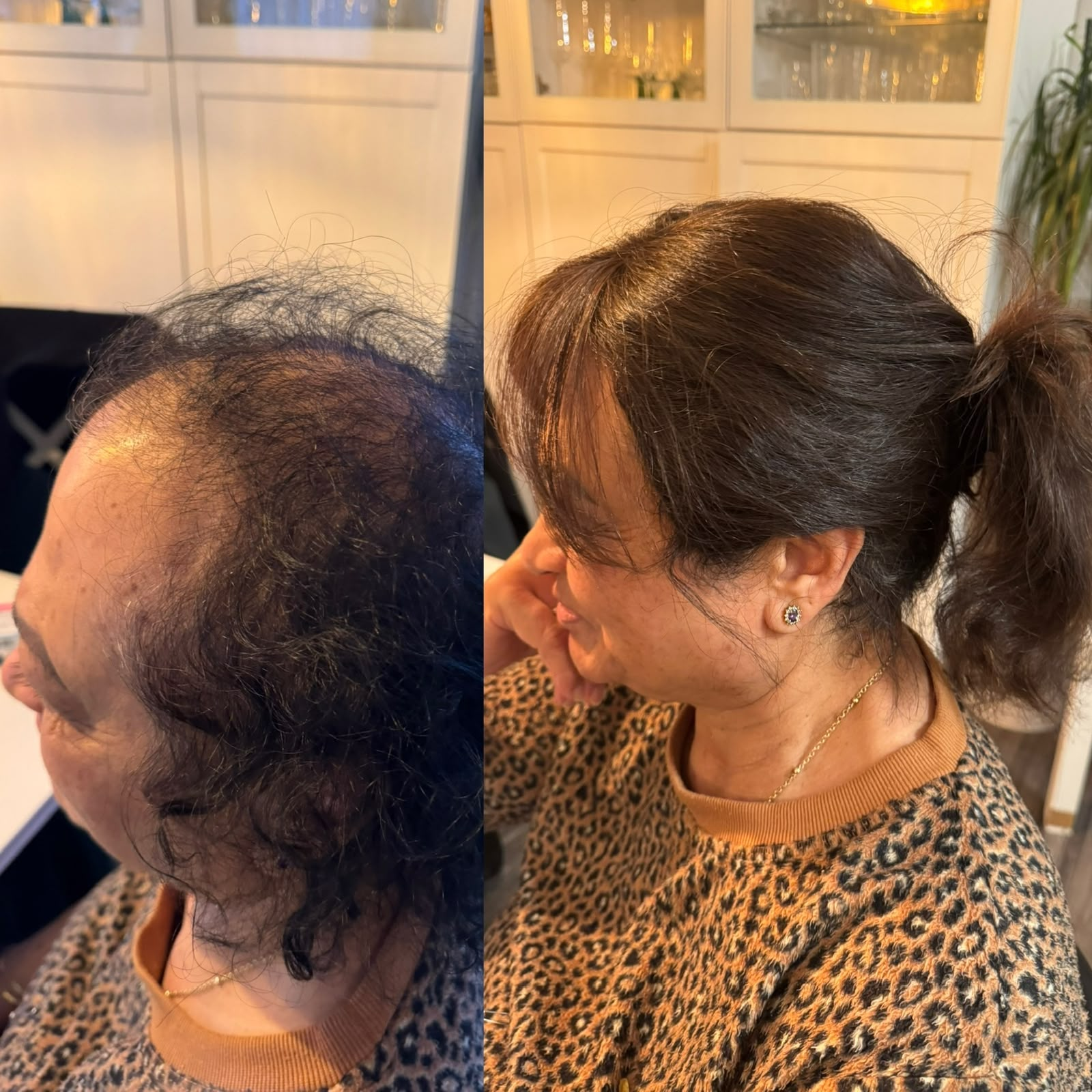 Hair topper