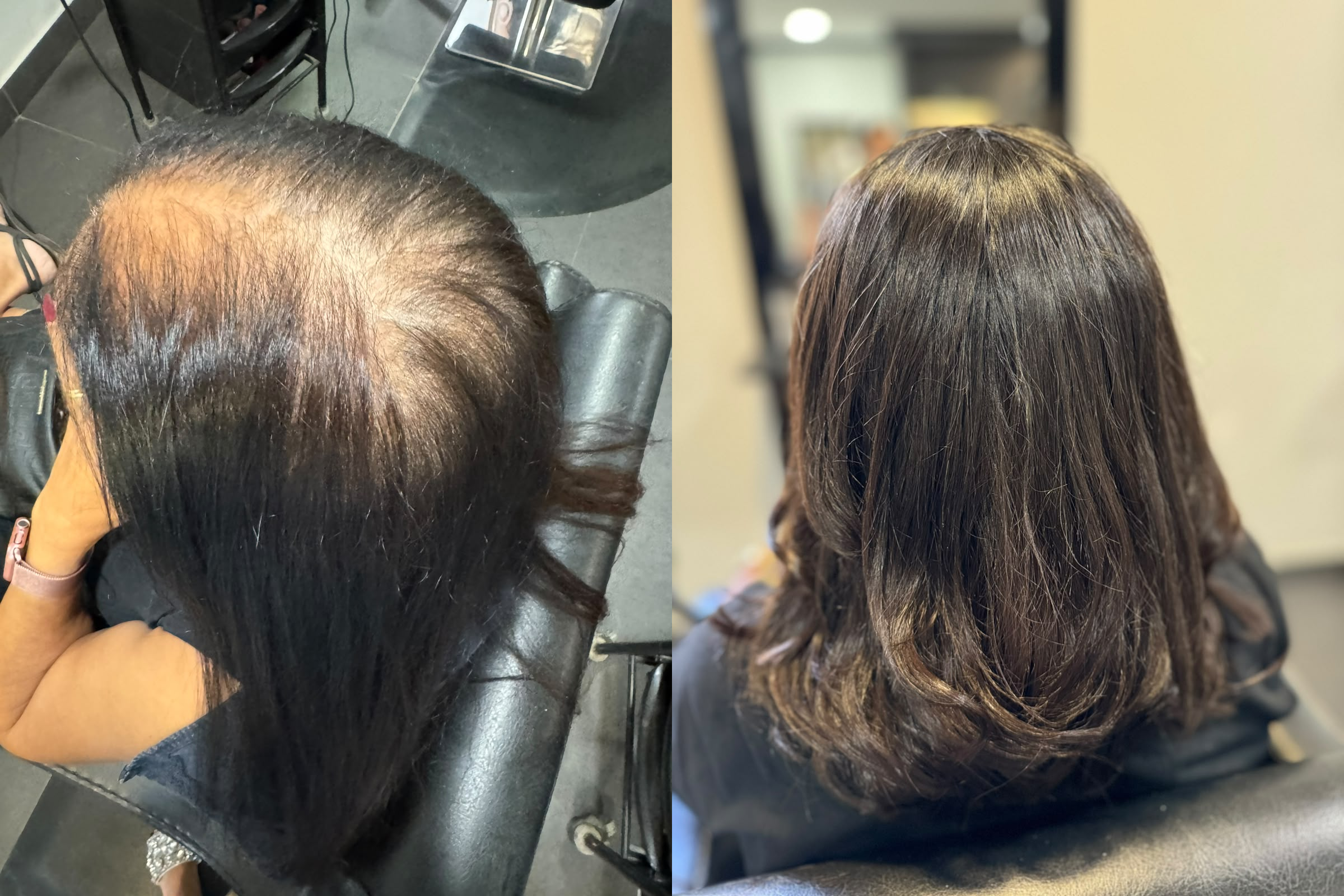 Hair topper